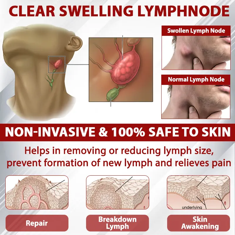 Advanced CVI Edema Therapy Cream - Image 9