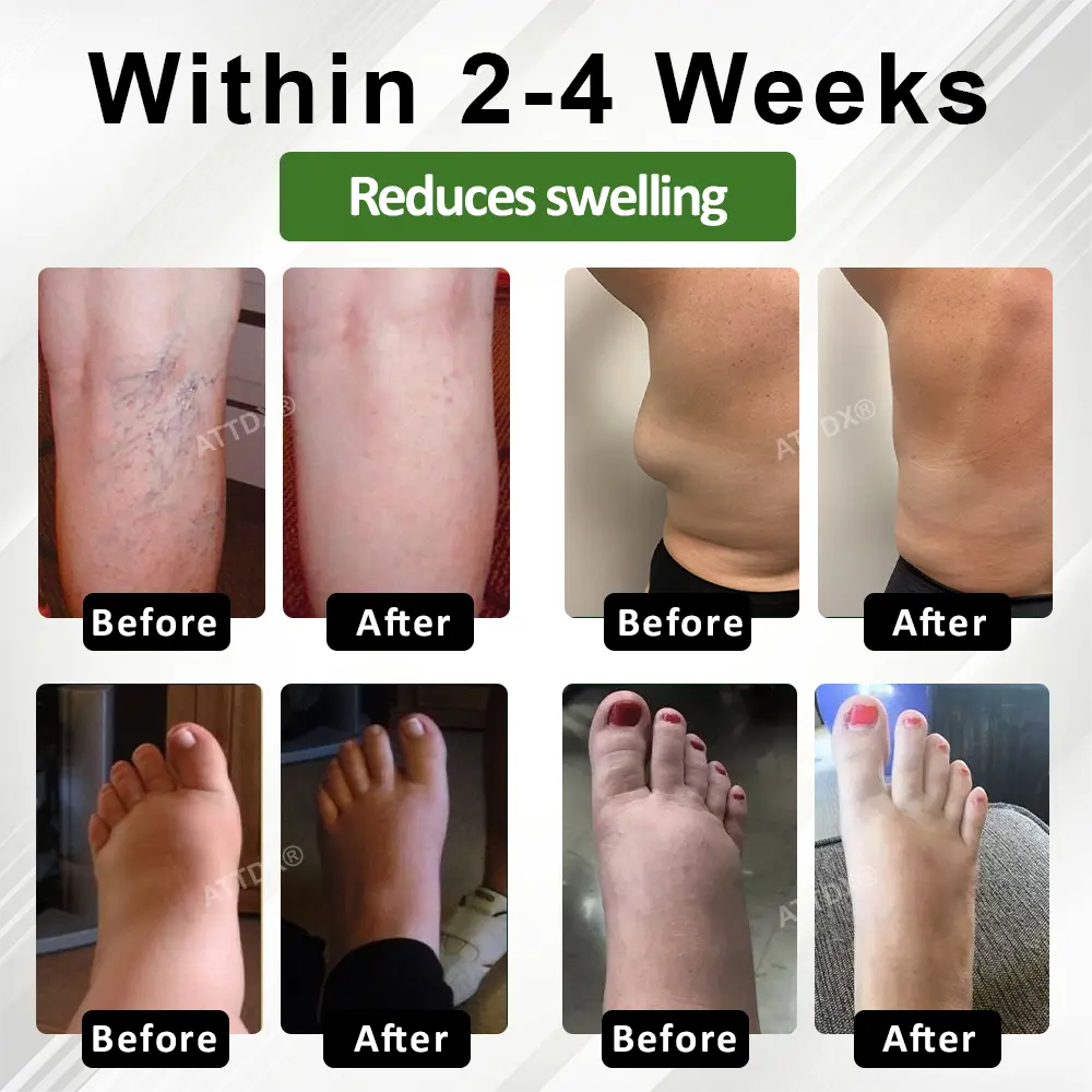 SpiculeFlow Advanced Edema Drainage Cream - Image 6