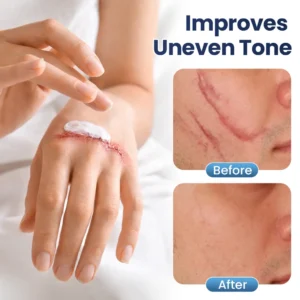 Texture Repair Gel - Image 4
