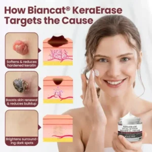 KeraErase Dual-Action Renewal Cream - Image 7