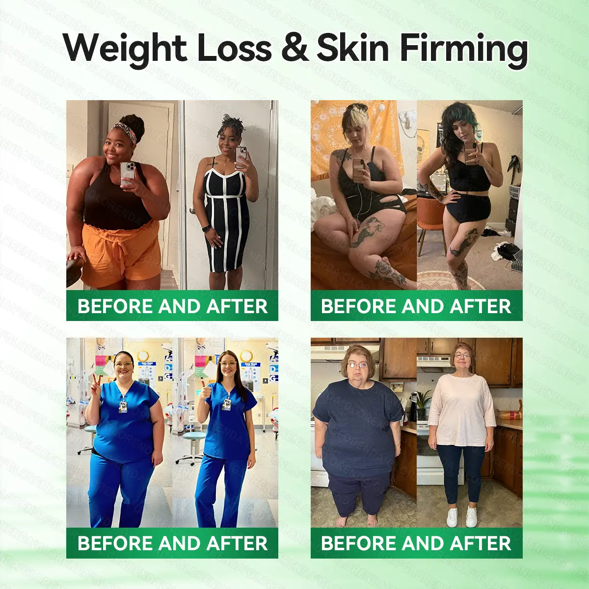 Caffeine · L-Carnitine × Retinol | Slimming & Firming 2-in-1 Nano Microneedle Patch - Image 2