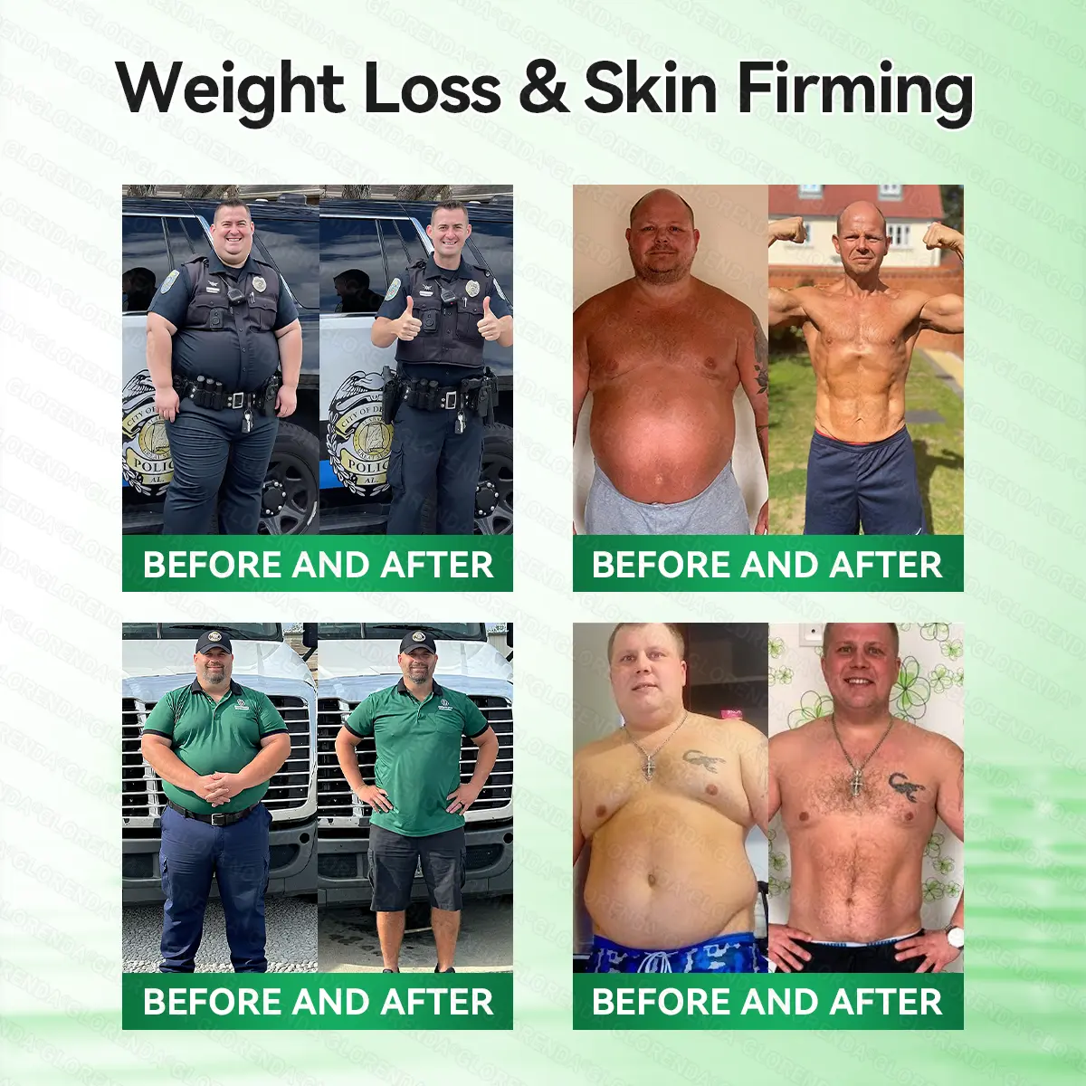 Caffeine · L-Carnitine × Retinol | Slimming & Firming 2-in-1 Nano Microneedle Patch - Image 3