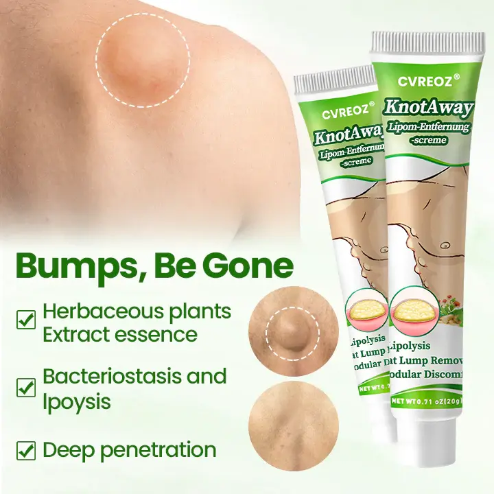 KnotAway Lipoma Removal Cream - Image 5