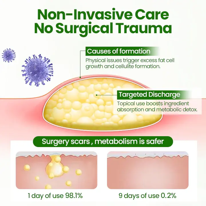 KnotAway Lipoma Removal Cream - Image 7