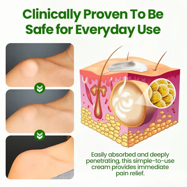 KnotAway Lipoma Removal Cream - Image 9