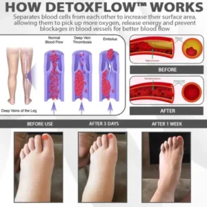 EdemaRelief Lymphatic Detox Cream - Image 9