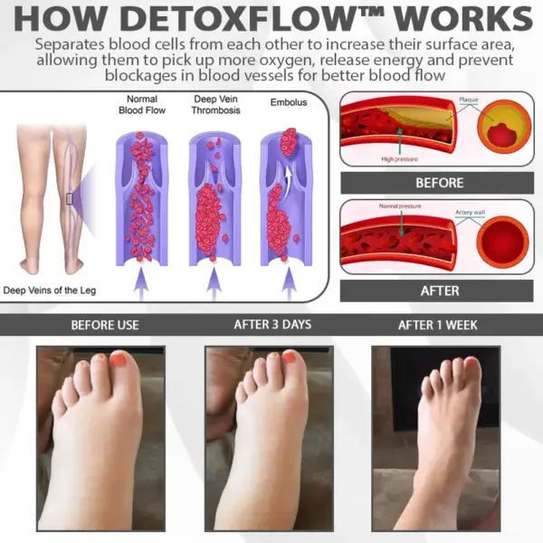 EdemaRelief Lymphatic Detox Cream - Image 9