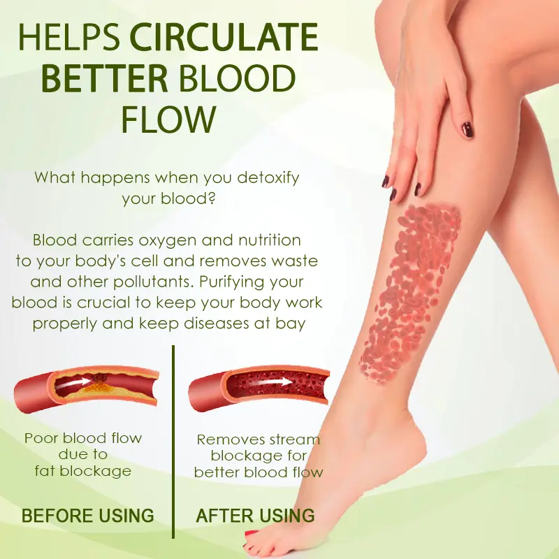 SwellFree Lymphatic Herbal Cream - Image 10