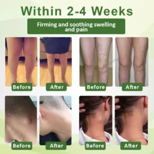 SwellFree Lymphatic Herbal Cream - Image 2
