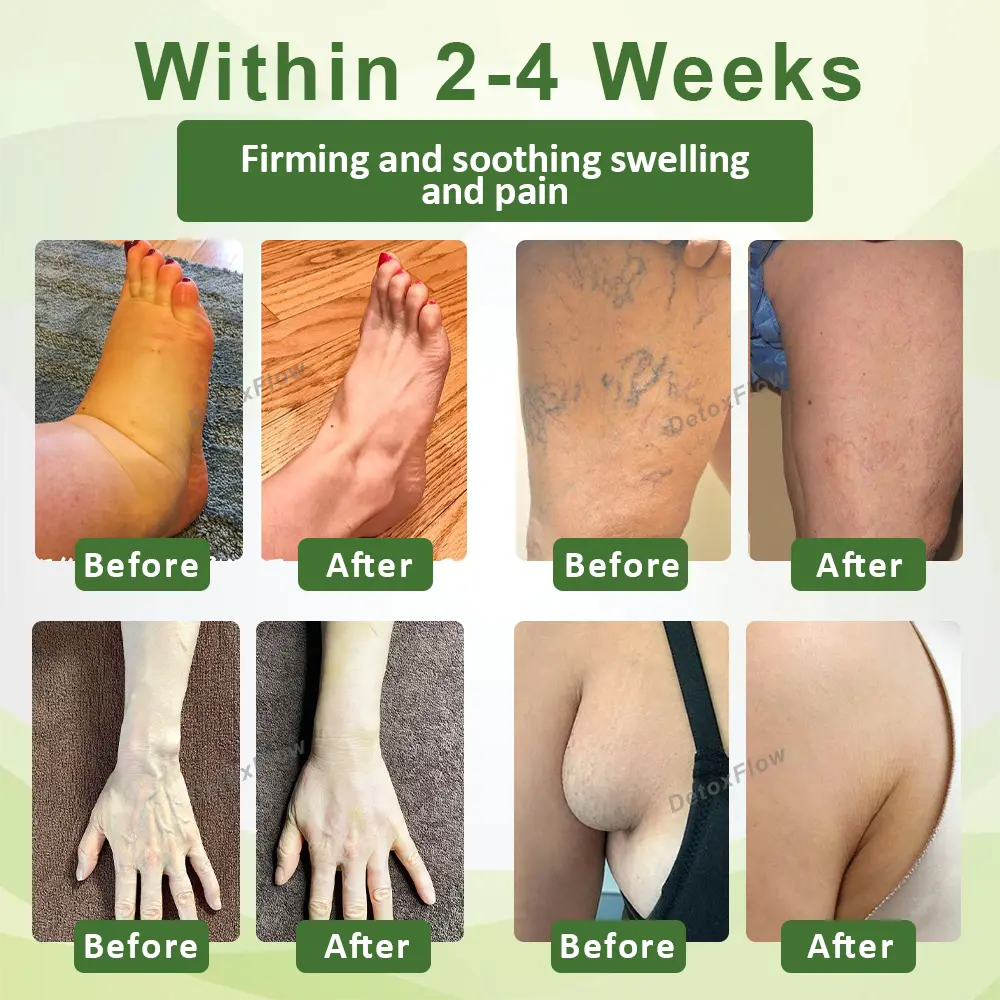 SwellFree Lymphatic Herbal Cream - Image 3