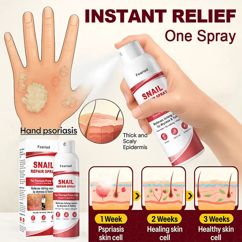Feariad Snail Repair Spray for Itchy, Flaky Psoriasis Skin - Image 5