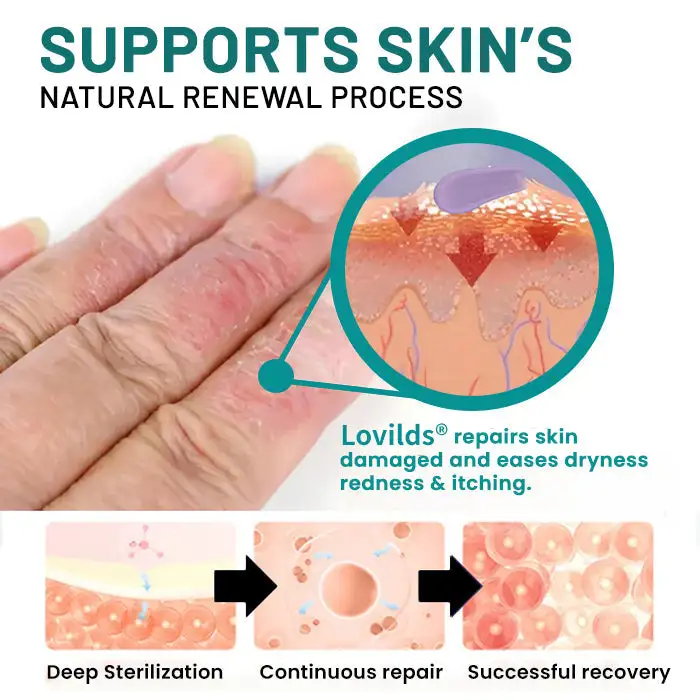 Probiotic + B 24-7 Moisture Eczema Relief Cream - Image 5