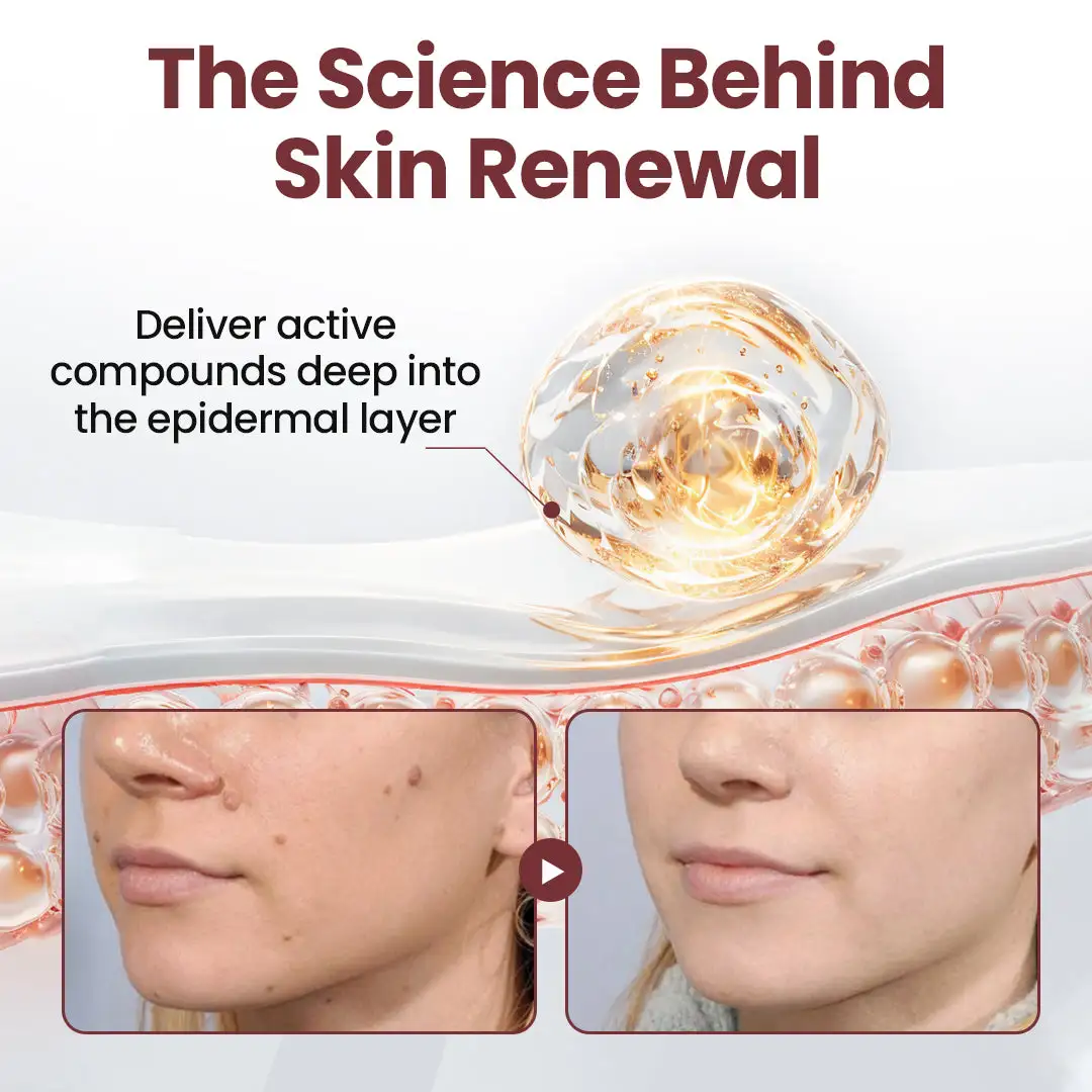 KeraErase Dual-Action Renewal Cream - Image 9