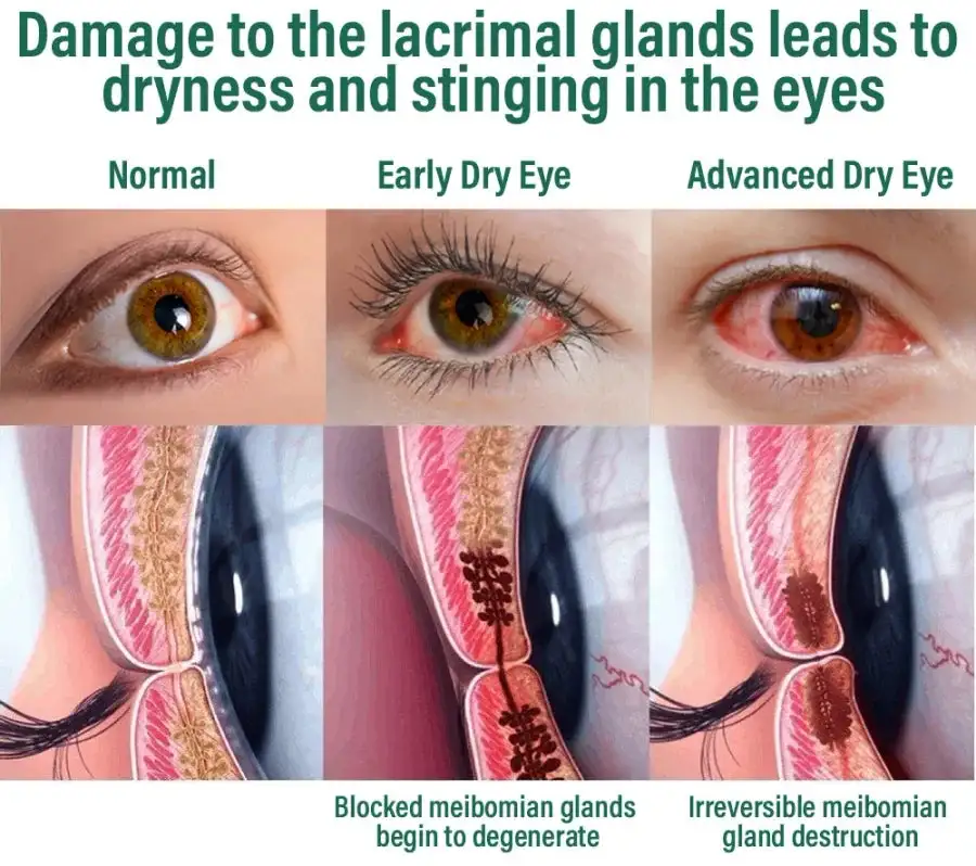 Nano Vision Repair Eye Serum - Image 16