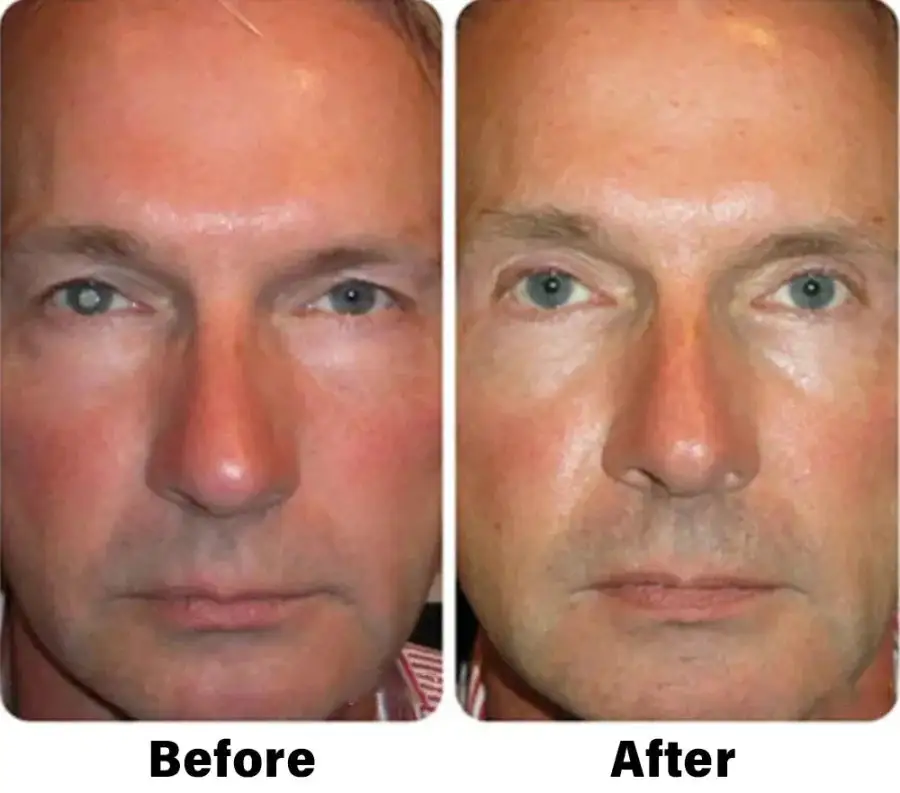 Nano Vision Repair Eye Serum - Image 11