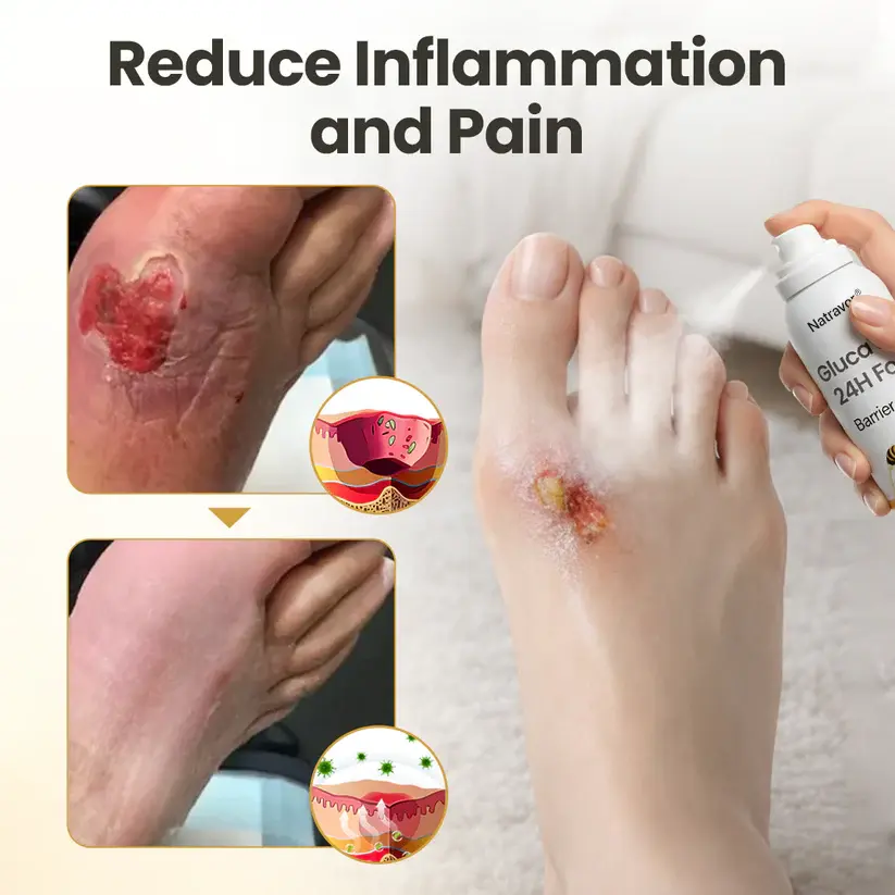 GlucaVeil 24H Foot Barrier Spray - Image 4