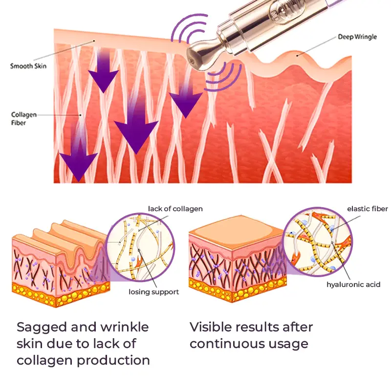 ✨RadianceEyes ✨ Pro-Vibrance Eye Cream Pen - Image 6