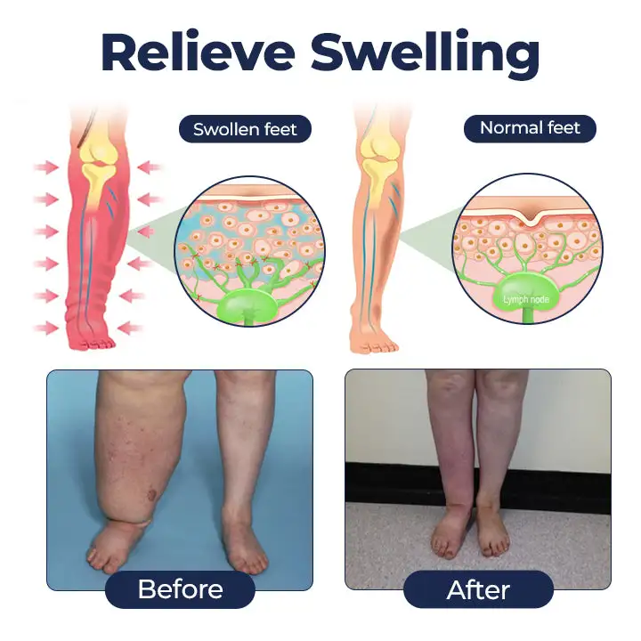 SwellRelief Circulation Support Cream - Image 3