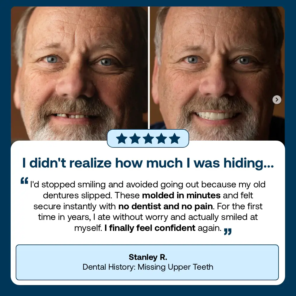 Full Denture with Strong Suctiond - Image 10
