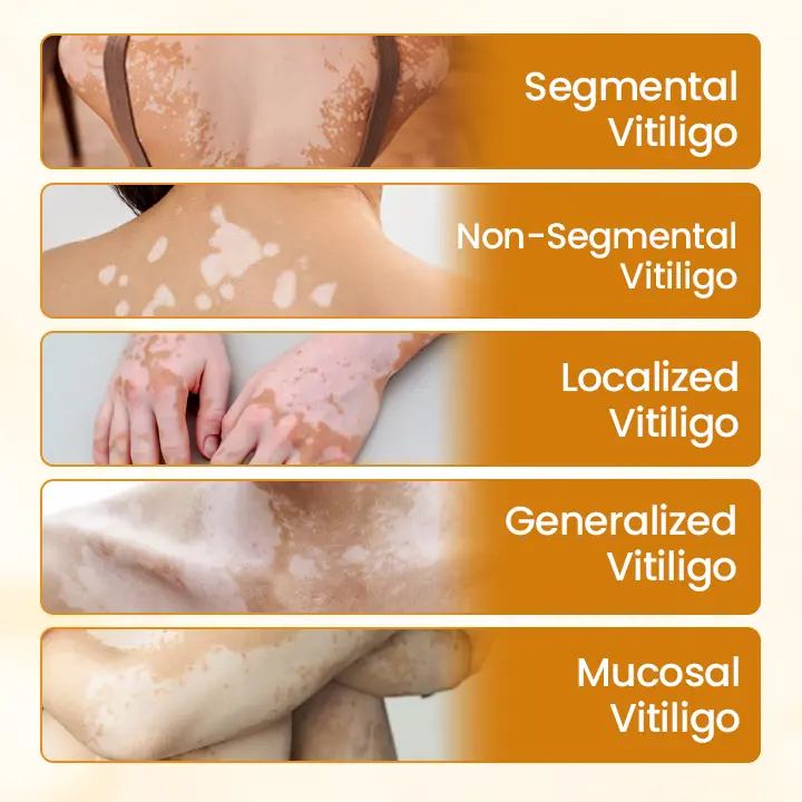 VitiClear Pro Bee Venom Cream - Image 9