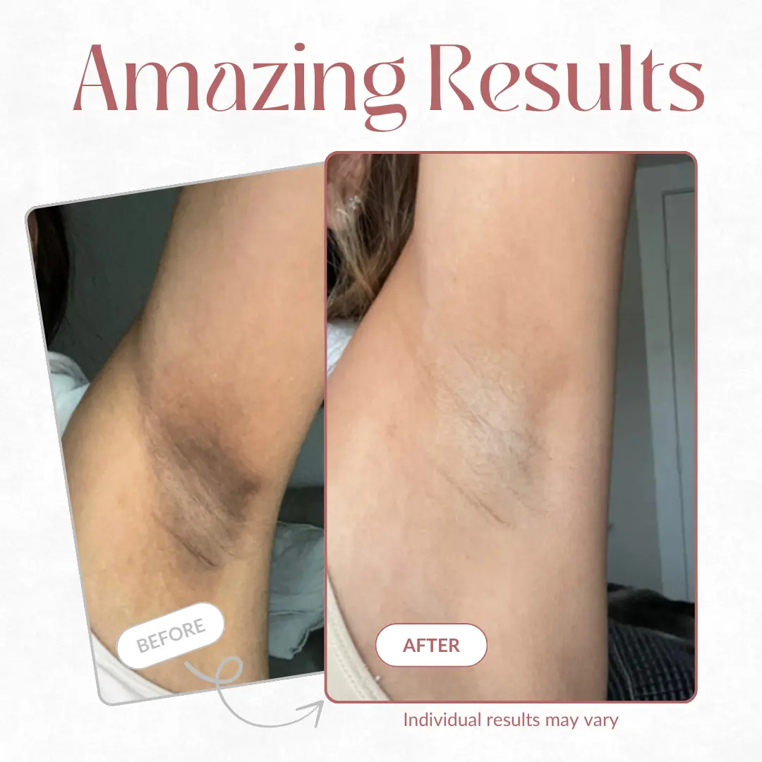 Peel Shot - Kojic + Turmeric Body Peel Spray - Image 3