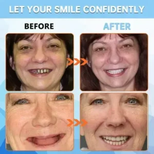 Adhesive teeth (upper and lower) - Image 8