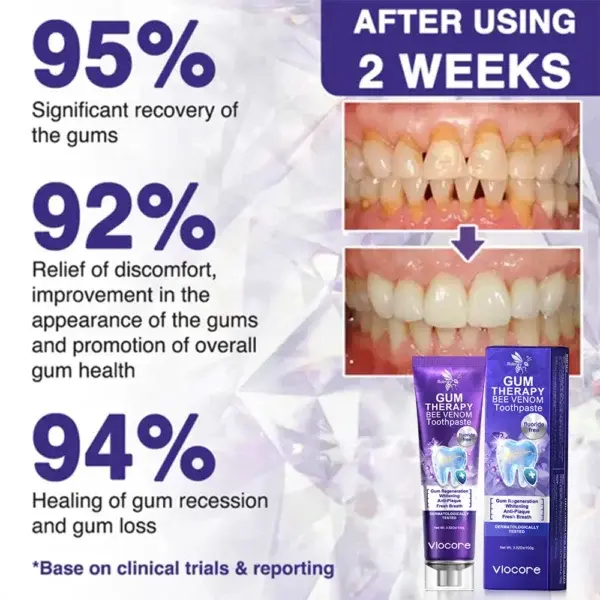 VioCore Bee Venom Dental Treatment Toothpaste - Image 10
