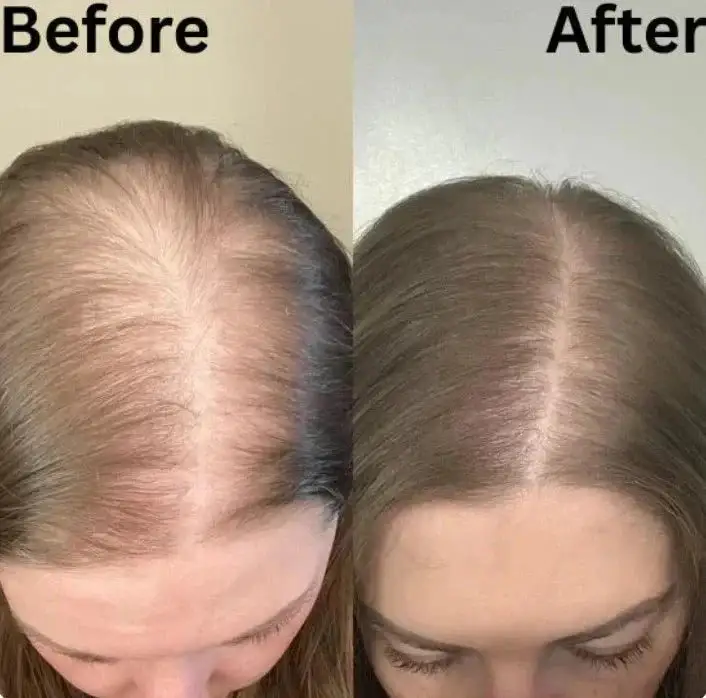 Rosemary Hydrolyzed Keratin Shampoo - Image 9