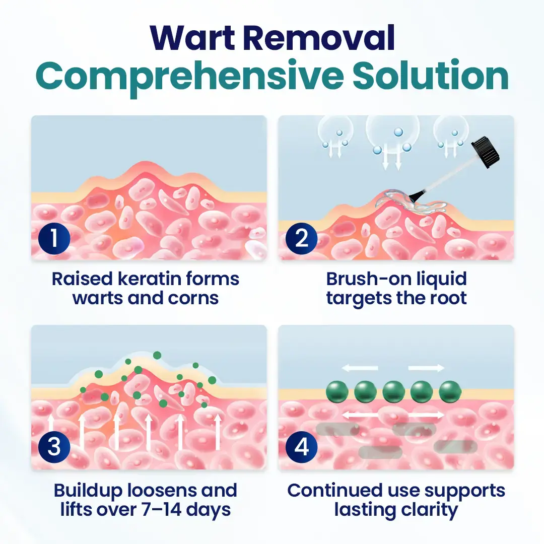 Wart Lift Wart Removal Liquid - Image 8