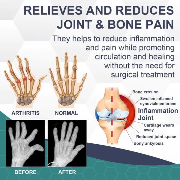 Bee Venom Pain and Bone Healing Cream - Image 4