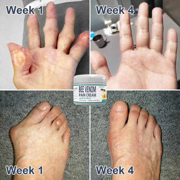 Bee Venom Pain and Bone Healing Cream - Image 3