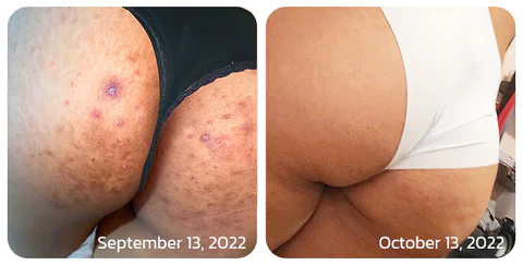 BodyTreat Collagen Exfoliating Essence - Image 7