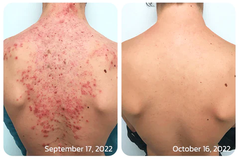 BodyTreat Collagen Exfoliating Essence - Image 3