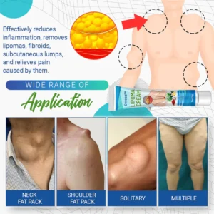 Lipoma Removal Cream - Image 10