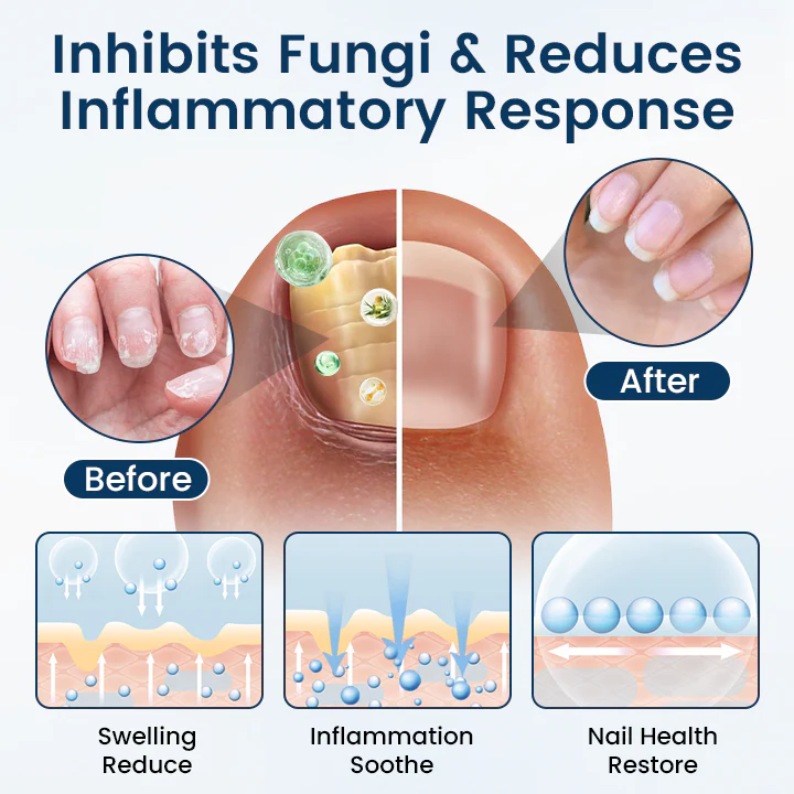 NailGuard Fungal Repair Herbal Spray - Image 10
