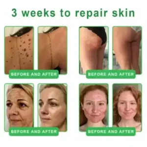 𝐀𝟏𝟎+ 𝟔-𝐢𝐧-𝟏 𝐃𝐞𝐫𝐦𝐚𝐑𝐞𝐩𝐚𝐢𝐫 𝐒𝐞𝐫𝐮𝐦 - Image 11