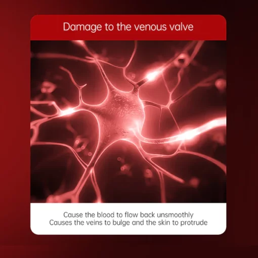 Varicose Veins Relief Cream - Image 2
