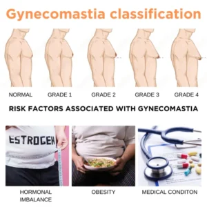 Gynecomastia Cream - Image 5