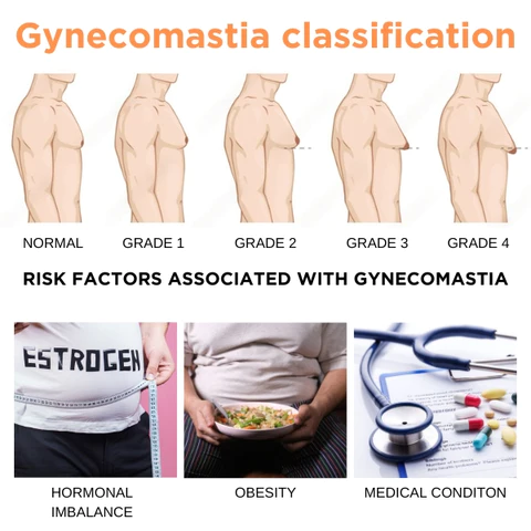 Gynecomastia Cream - Image 5