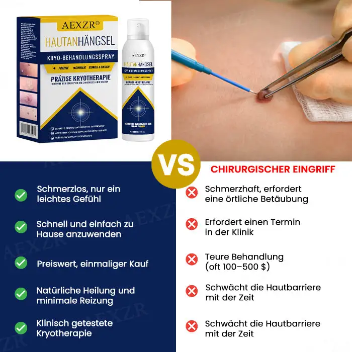 Hautanhängsel-Kryo-Behandlungsspray - Image 5