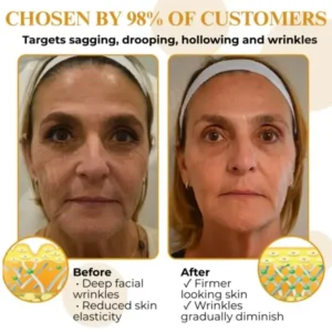 Letybo Bee Venom Wrinkle Removal Cream - Image 4