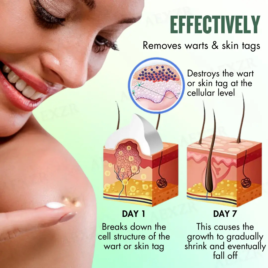 WartsOff Instant Blemish Removal Cream - Image 6