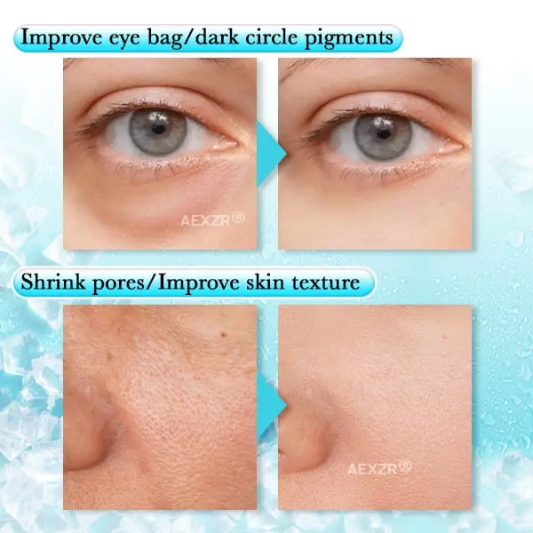 Anti-swelling Gel Beads Facial Therapy Mask - Image 8