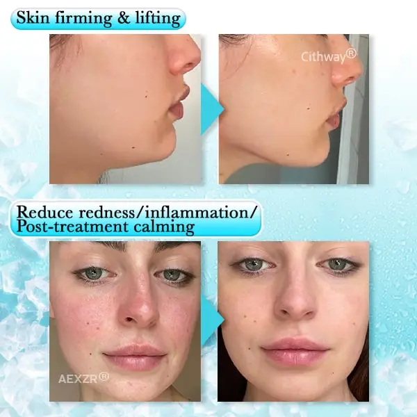 Anti-swelling Gel Beads Facial Therapy Mask - Image 7
