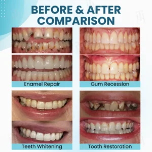 Makesmile Bee Venom Oral Treatment Powder - Image 3