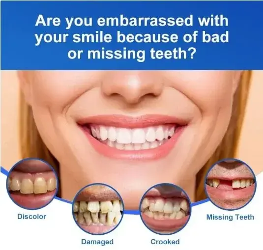 -🦷Advanced Customized Full Denture Set🦷 - Image 4