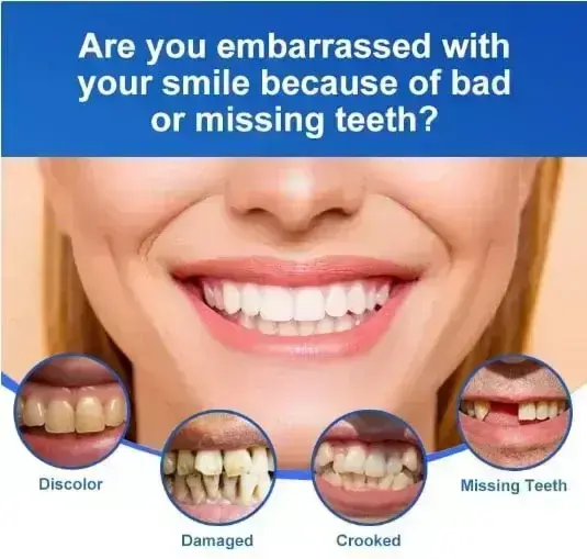 -🦷Advanced Customized Full Denture Set🦷 - Image 4