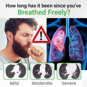 SpireFresh Quercetin Lung Detox Inhaler - Image 10