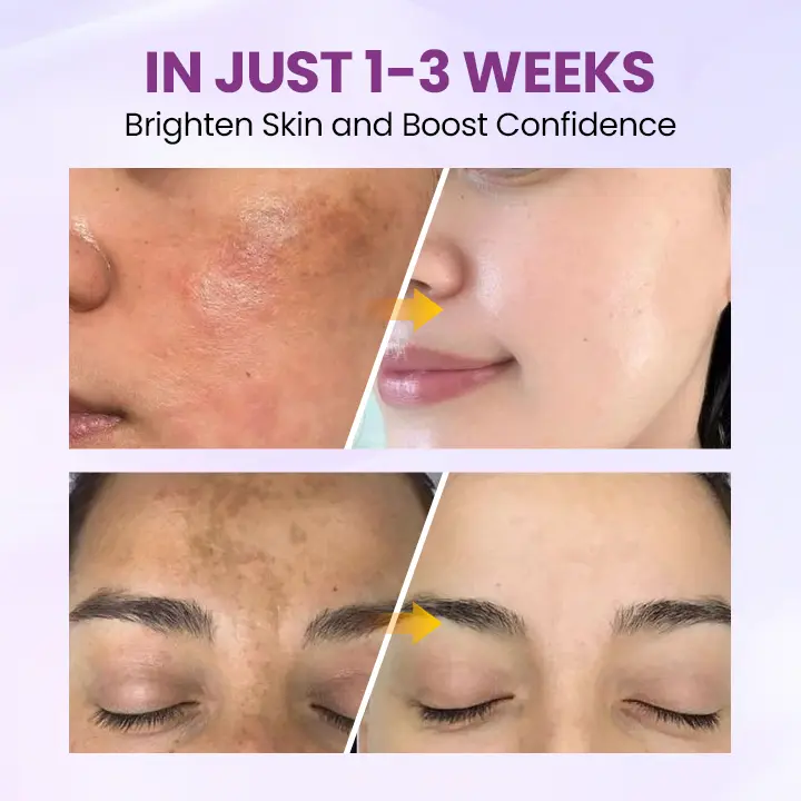 Radiant Clear Blemish & Brightening Serum - Image 5