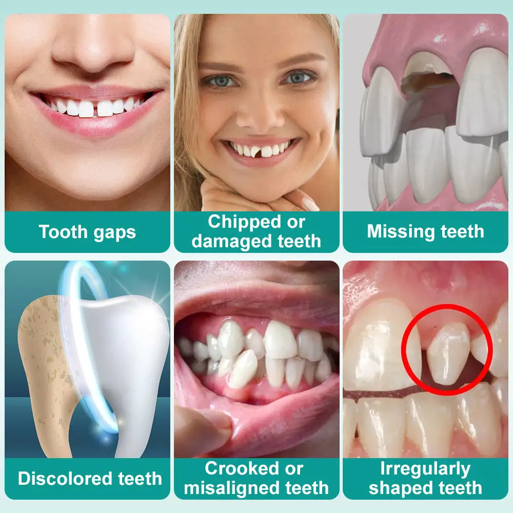 𝗜𝗻𝘀𝘁𝗮𝗻𝘁 𝗦𝘁𝗶𝗰𝗸-𝗼𝗻 𝗗𝗲𝗻𝘁𝗮𝗹 𝗩𝗲𝗻𝗲𝗲𝗿𝘀 (✅Clinically proven, easy-to-use dental veneers trusted by over 8,000 US users for a comfortable, natural smile.) - Image 8